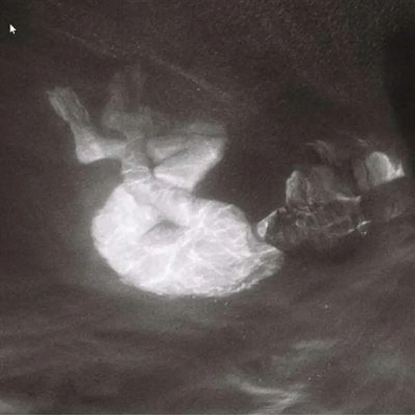 Alice Phoebe Lou Glow Vinyl Record