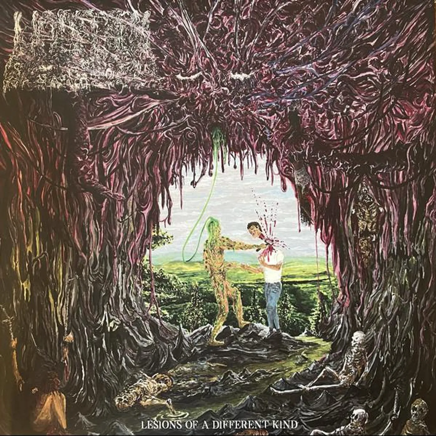 Undeath Lesions of a Different Kind Vinyl Record