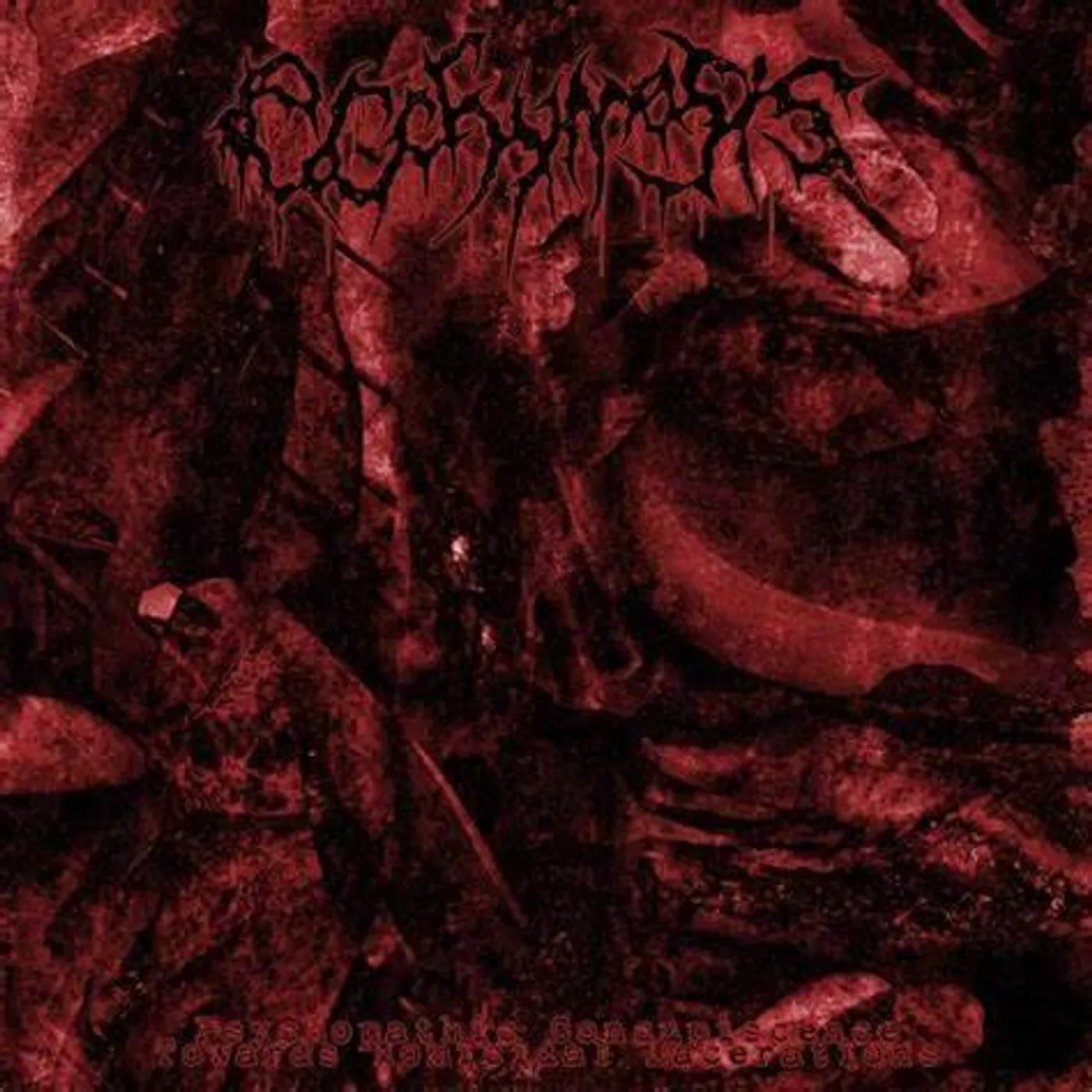 Ecchymosis PSYCHOPATHIC CONCUPISCENCE TOWARDS HOMICIDAL CD