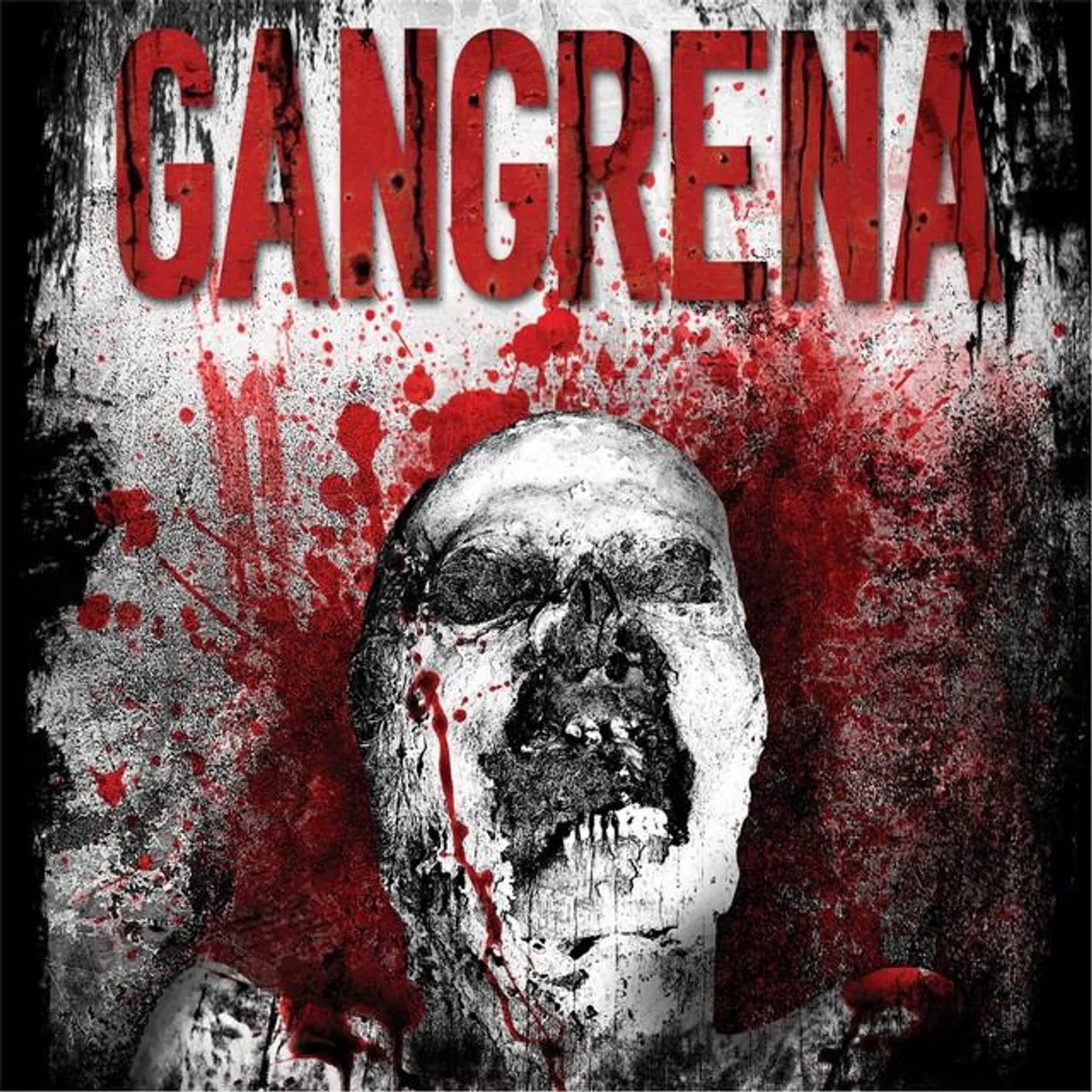 Gangrena