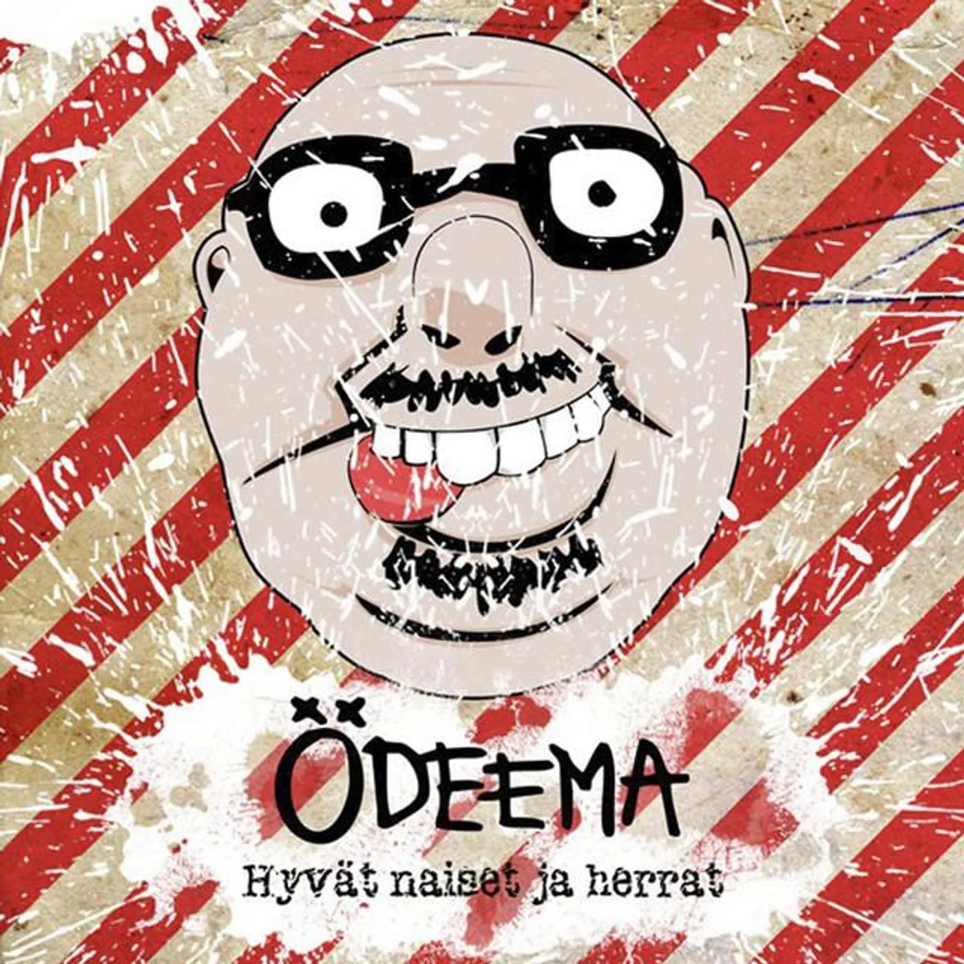 Ödeema