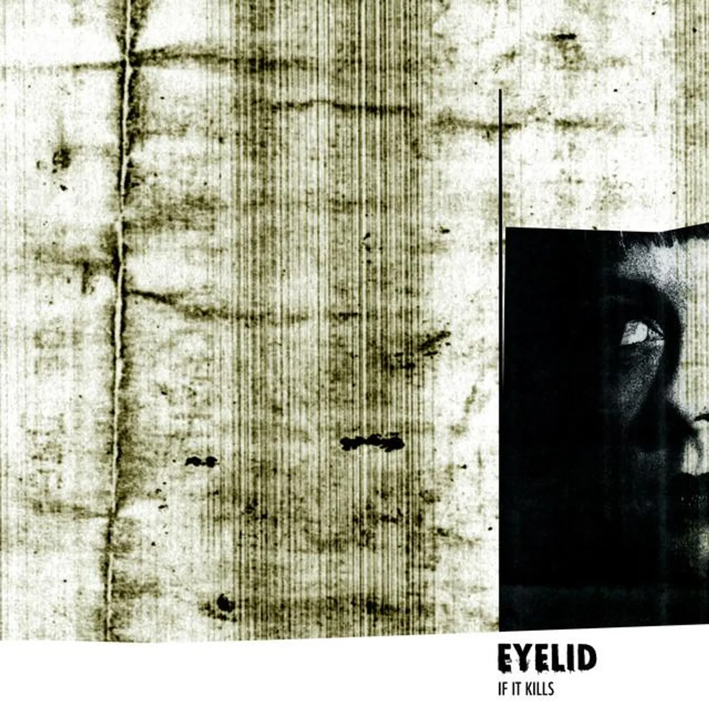 Eyelid