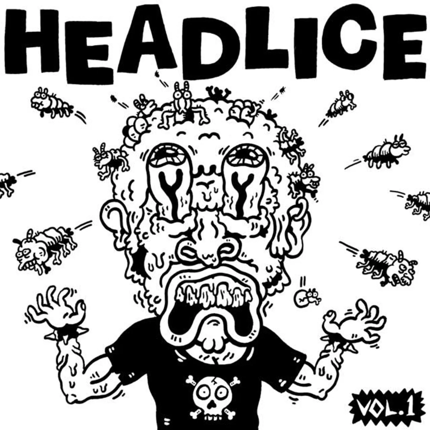 Headlice