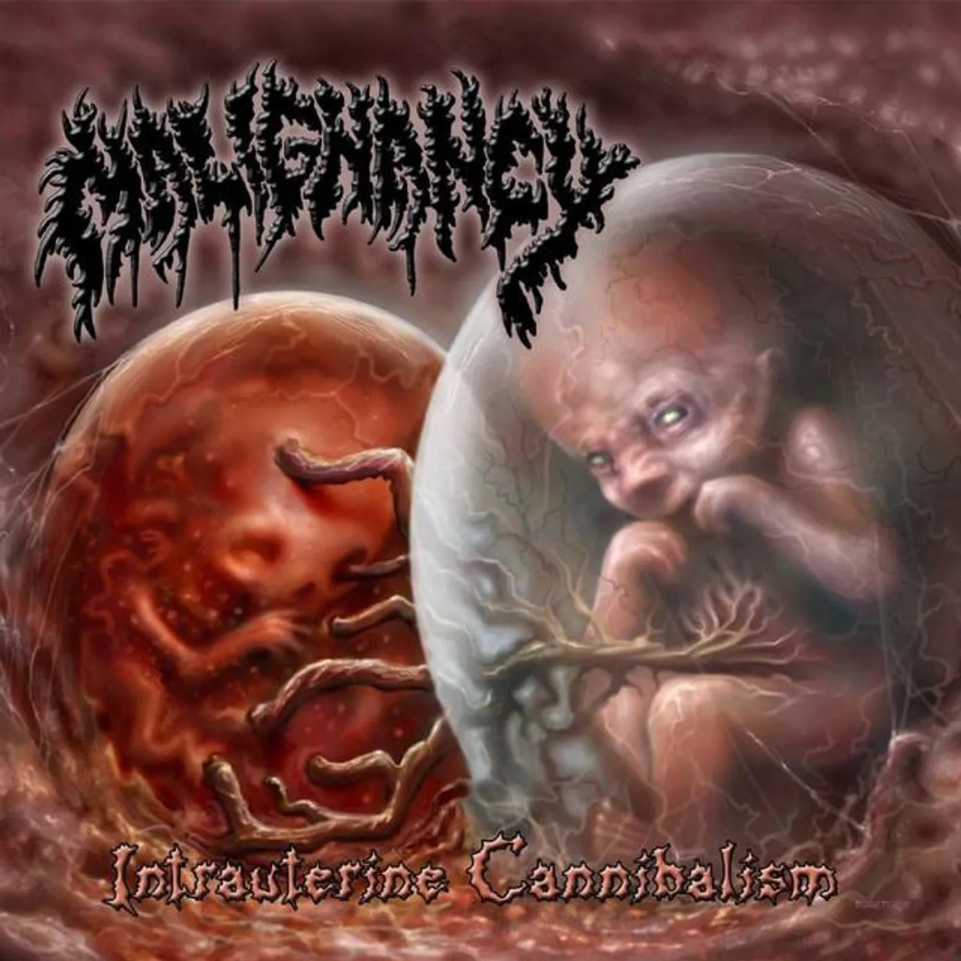Malignancy