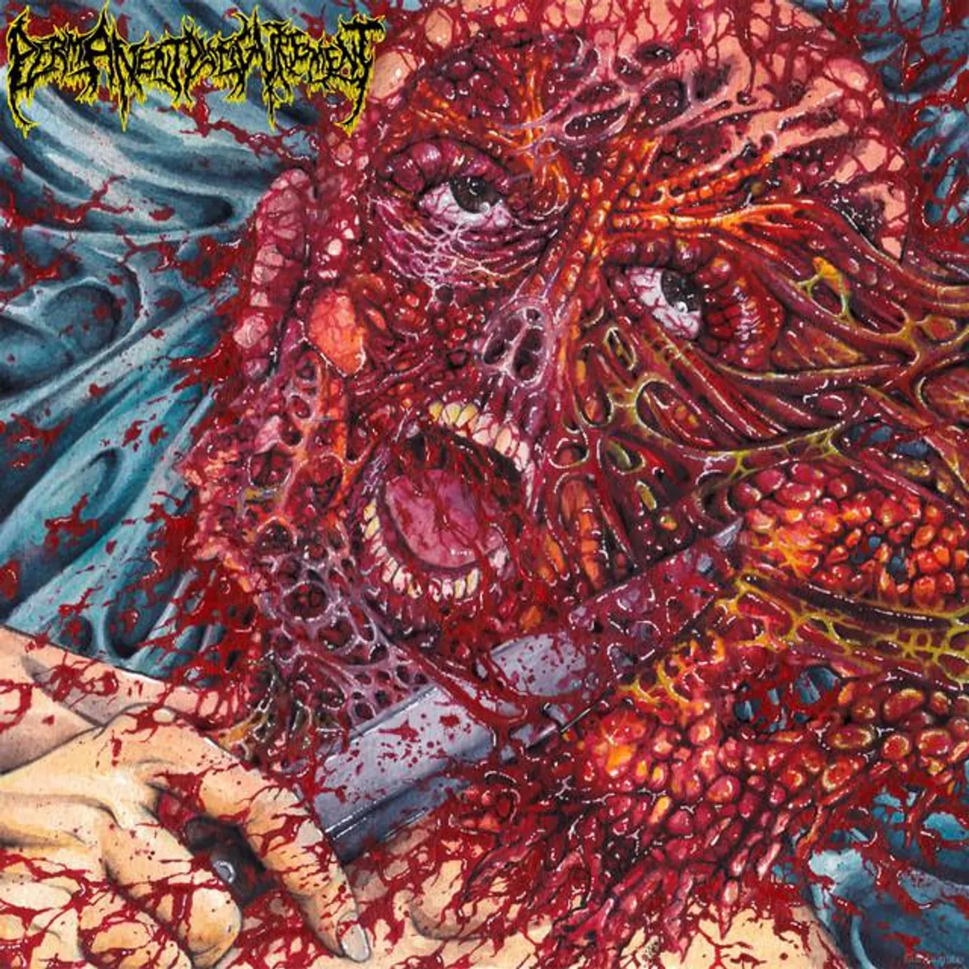 PERMANENT DISFIGUREMENT