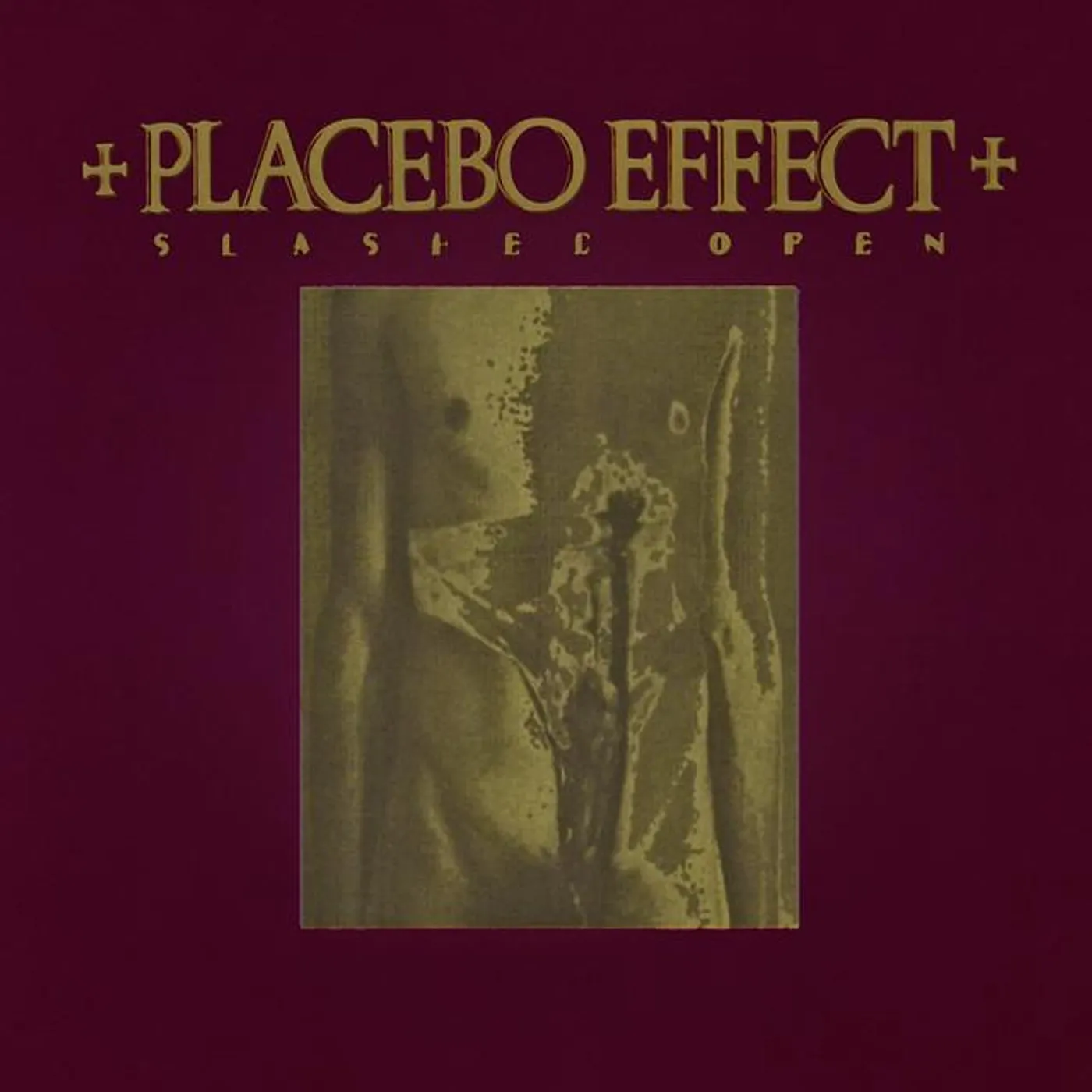 Placebo Effect