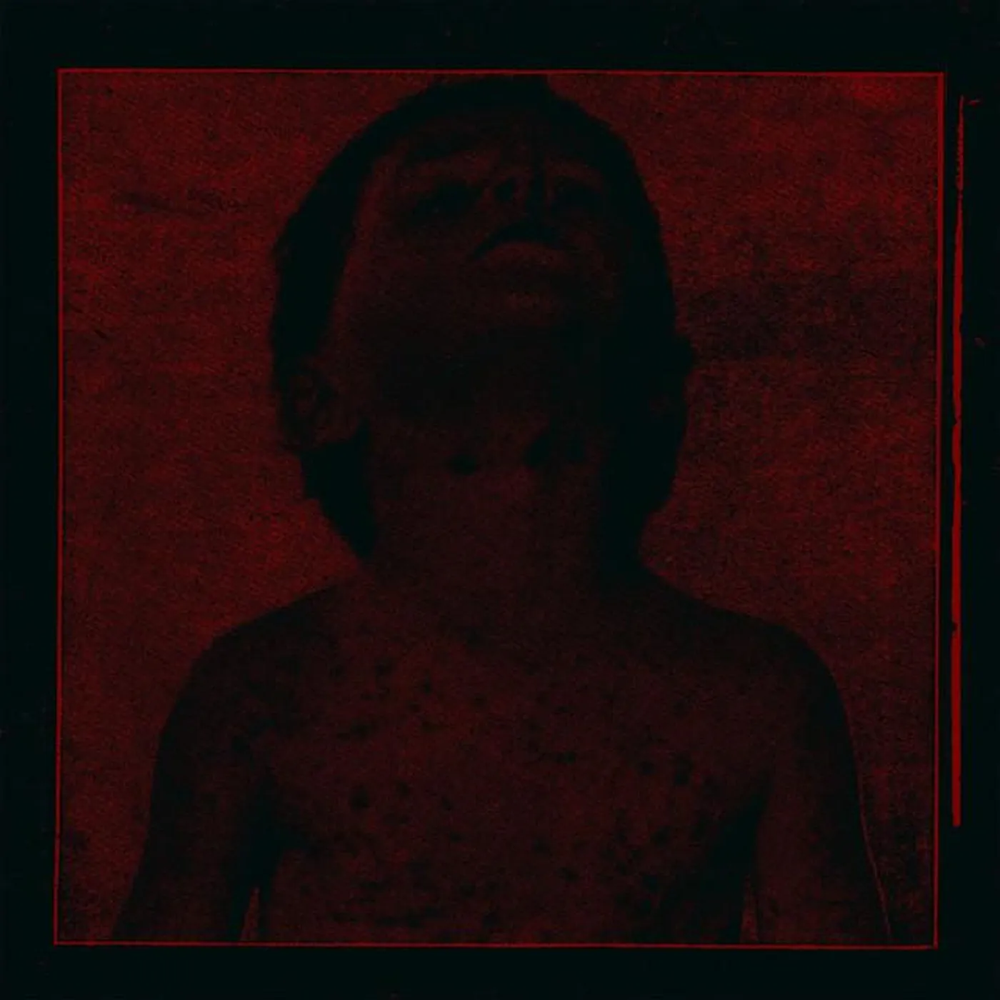 Rectal Hygienics Brand Page