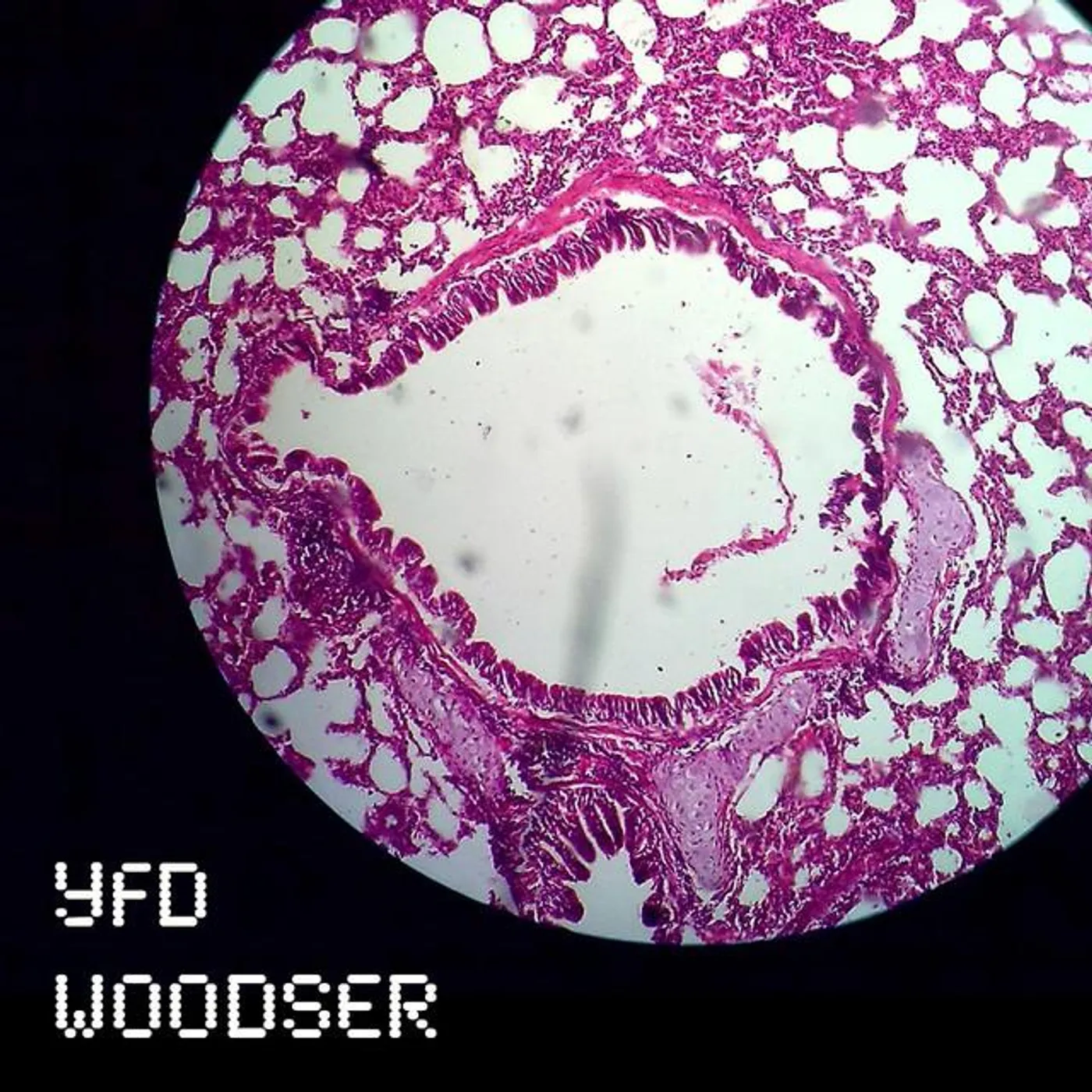 Woodser