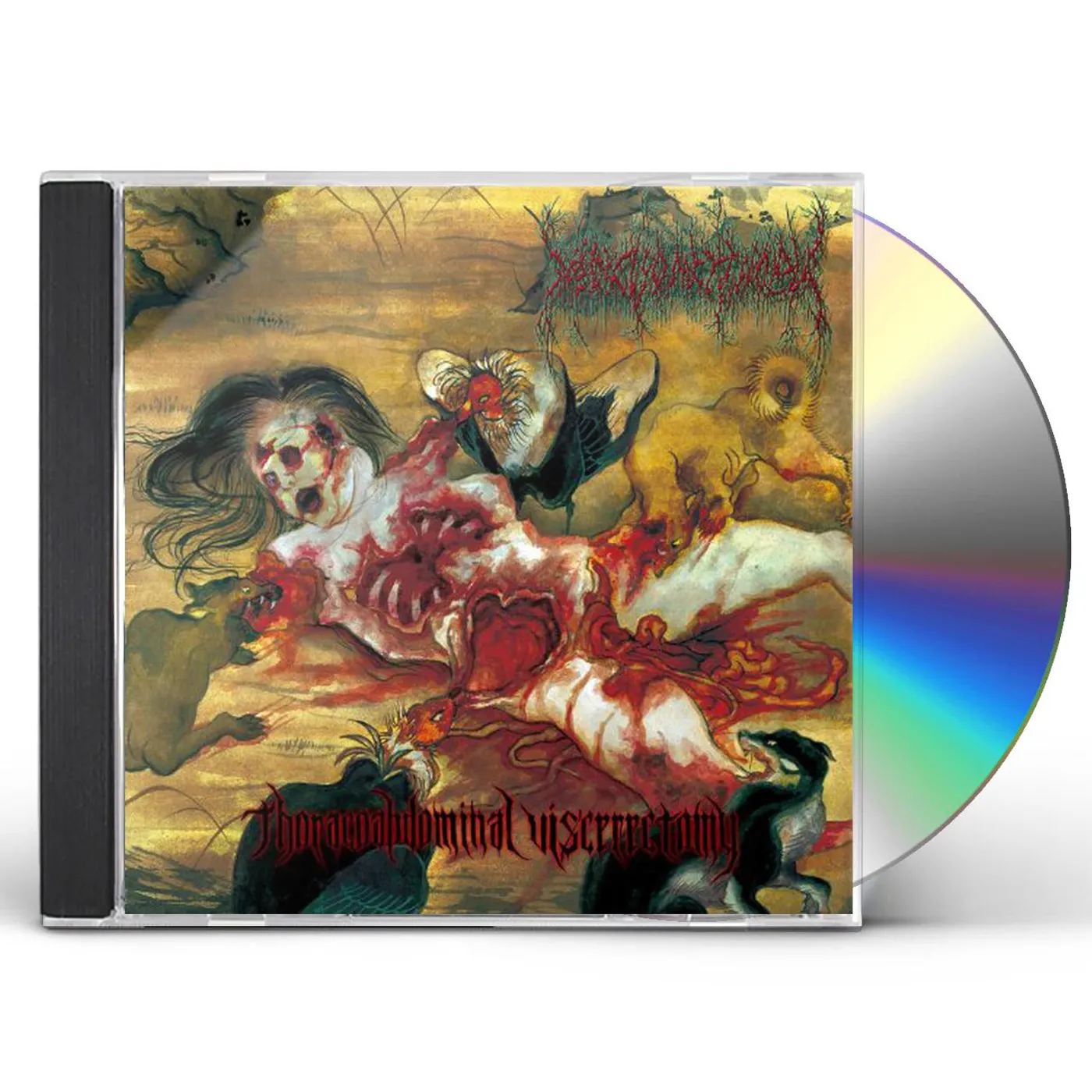Medic Vomiting Pus THORACOABDOMINAL VISCERECTOMY CD