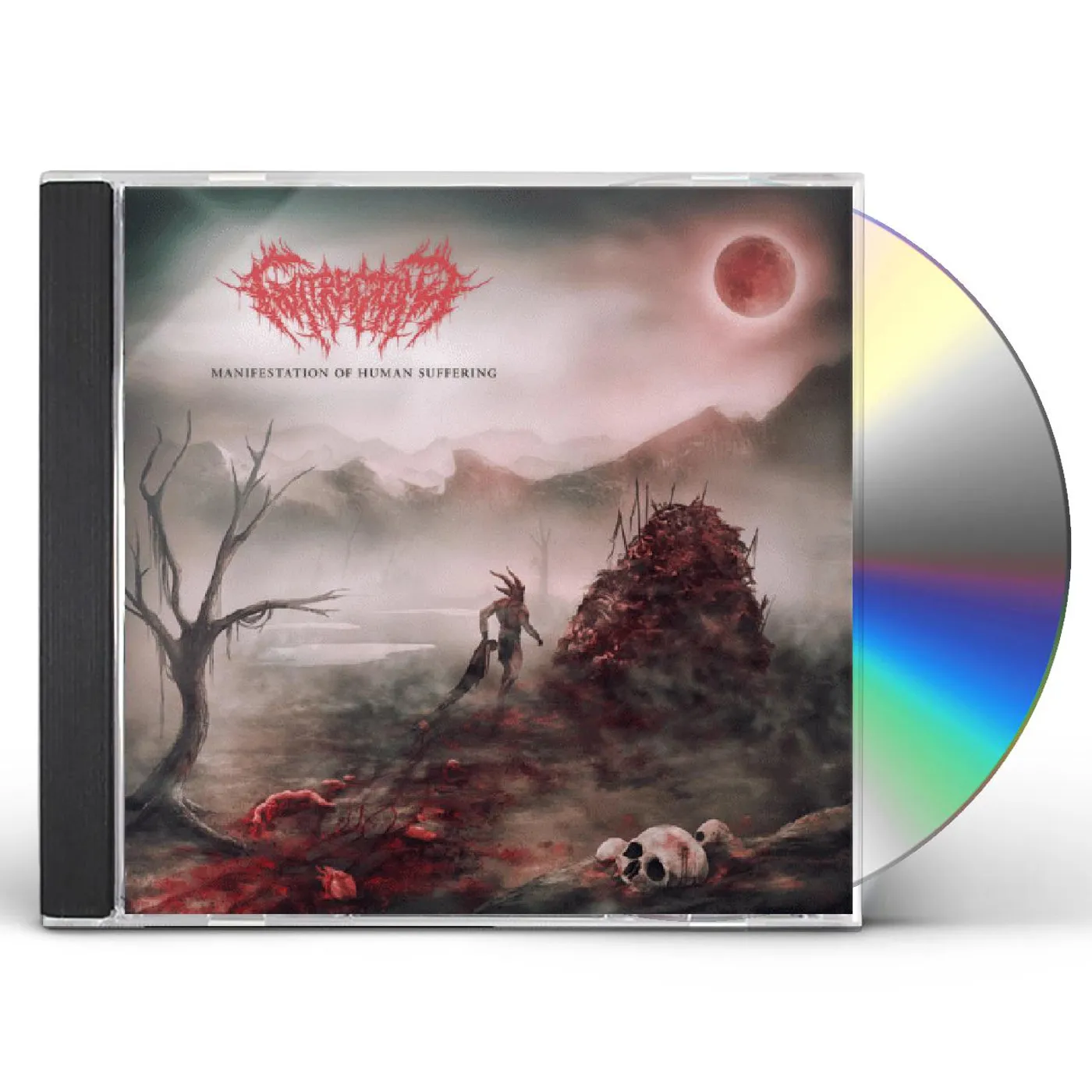 Gutrectomy Manifestation of Human Suffering CD