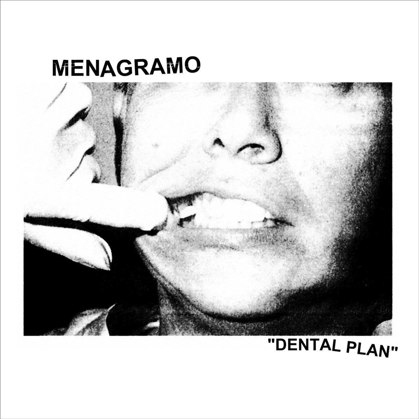 Menagramo Dental Plan (Green) Vinyl Record