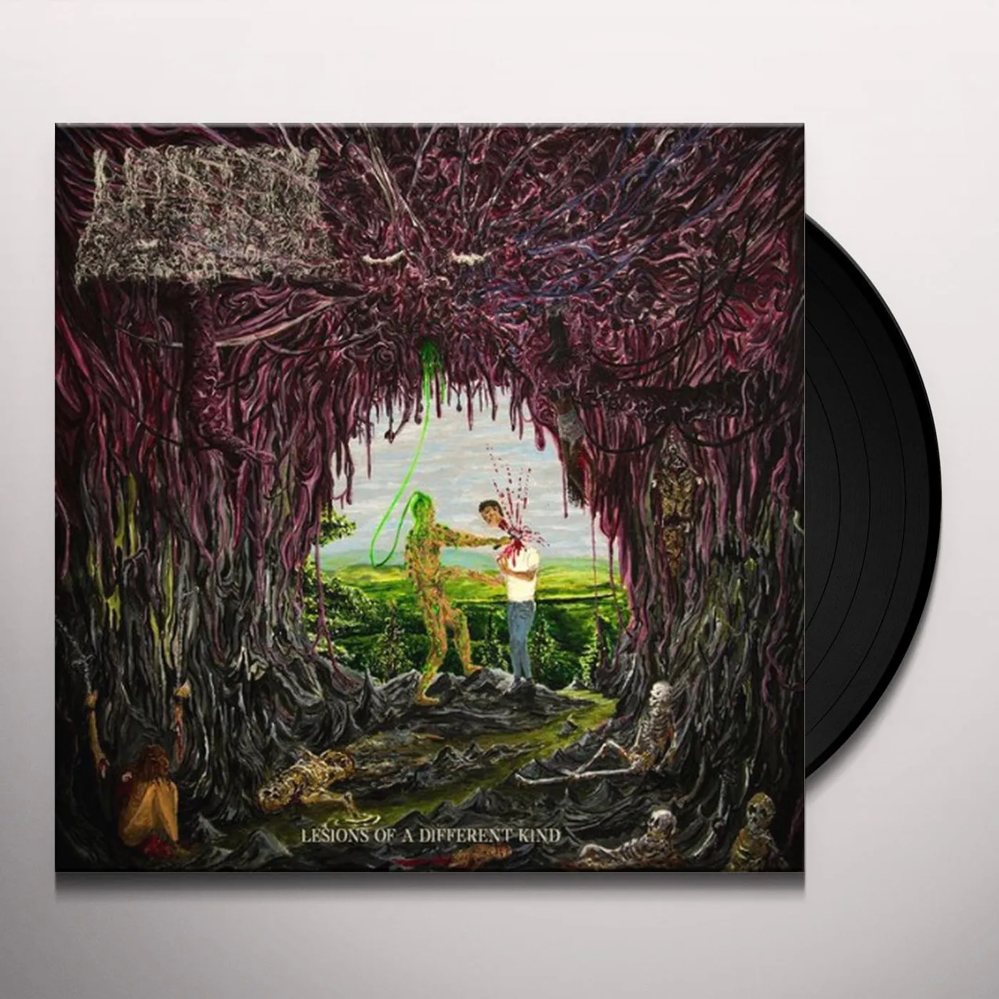 Undeath Lesions of a Different Kind Vinyl Record