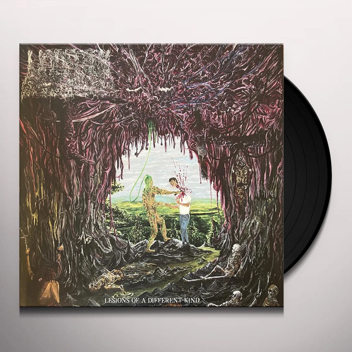 Undeath Lesions of a Different Kind Vinyl Record