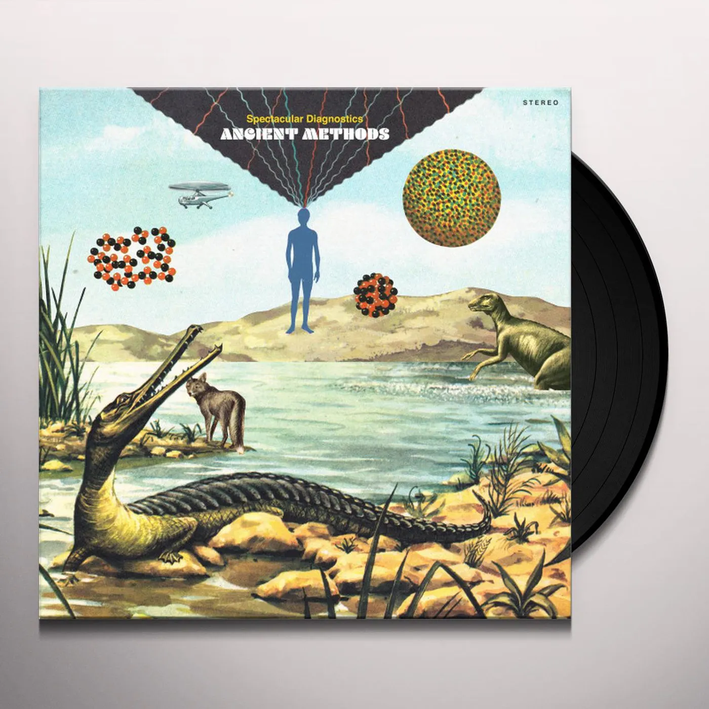 Spectacular Diagnostics Ancient Methods Vinyl Record