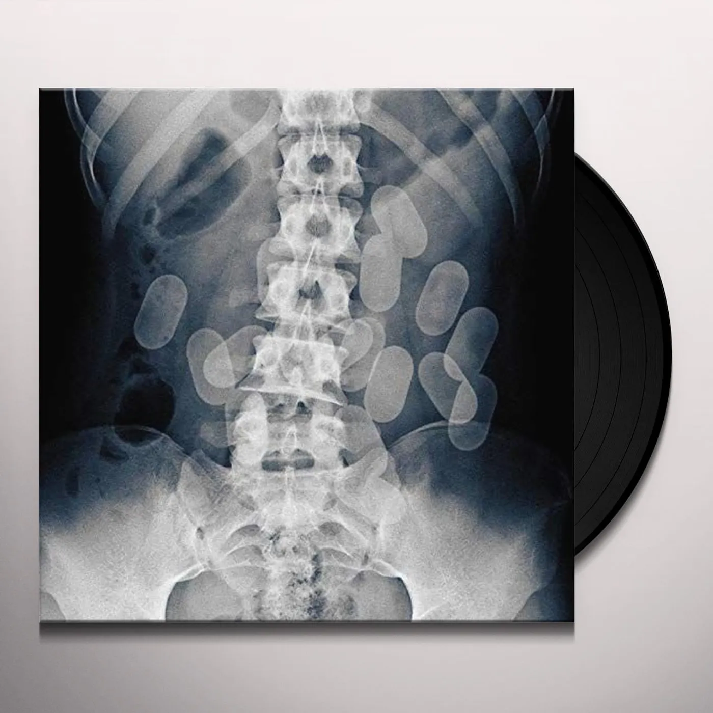 Night Skinny MATTONI X-RAY Vinyl Record