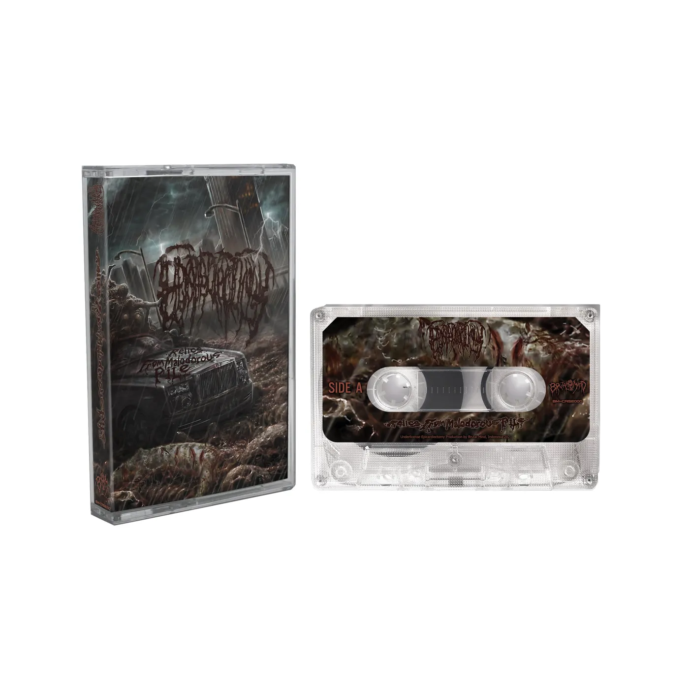 Epicardiectomy "Relics From Malodorous Pile" Cassette