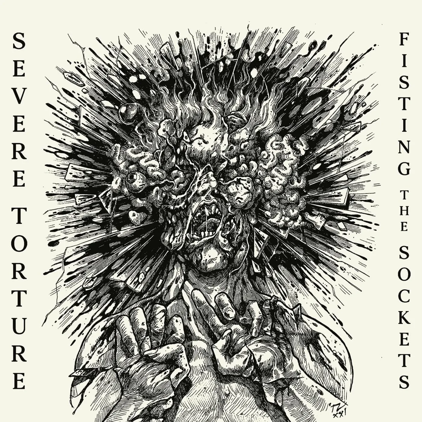 Severe Torture FISTING THE SOCKETS CD