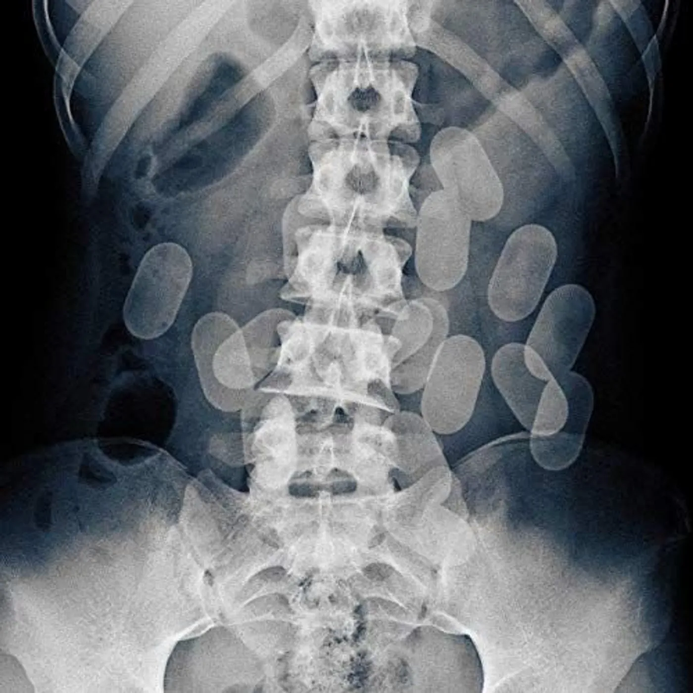 Night Skinny MATTONI X-RAY Vinyl Record