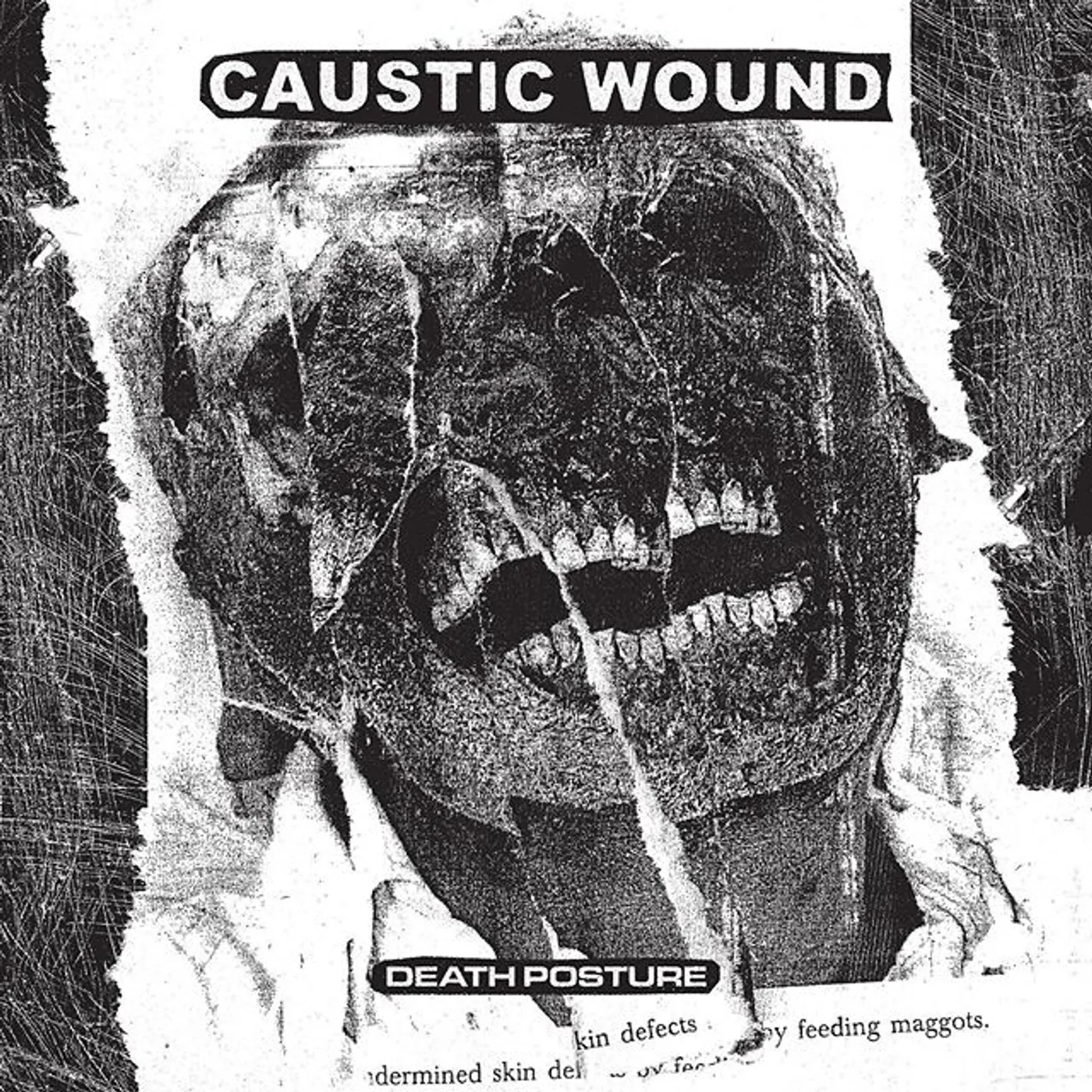 Caustic Wound Death Posture Vinyl Record