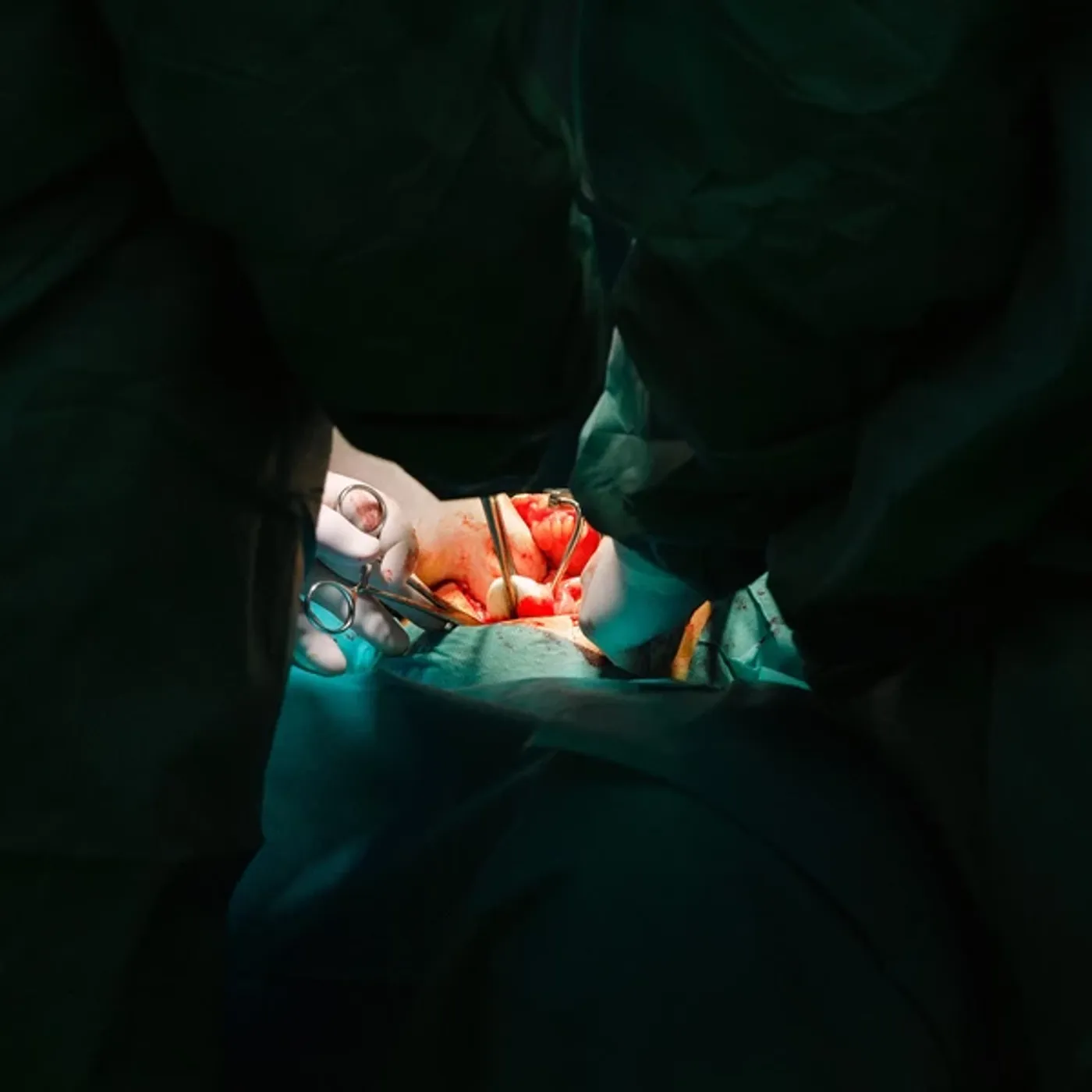 Maenad Veyl Reassessment Vinyl Record