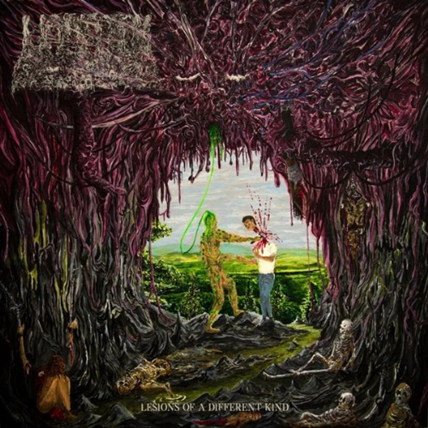 Undeath Lesions of a Different Kind Vinyl Record