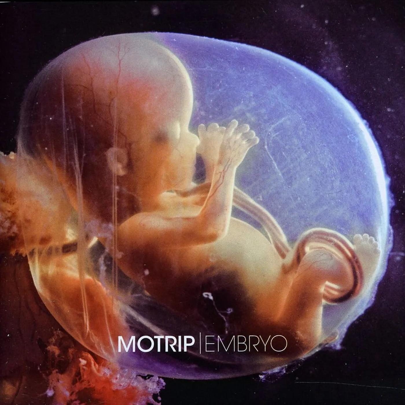 MoTrip EMBRYO CD
