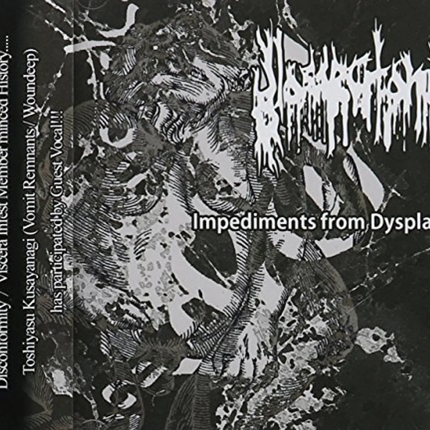 Glossectomy IMPEDIMENTS FROM DYSPLASIA CD