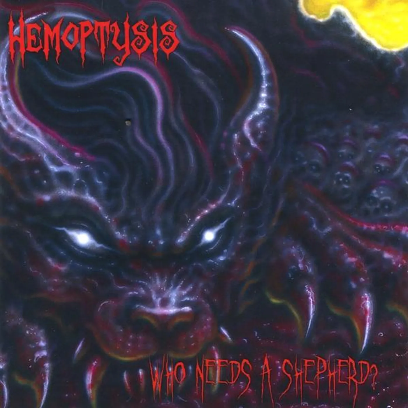 Hemoptysis WHO NEEDS A SHEPHERD? CD
