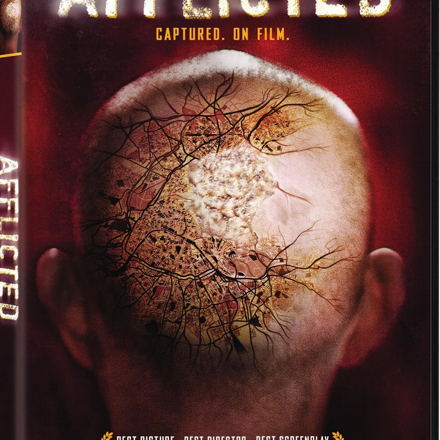 AFFLICTED DVD