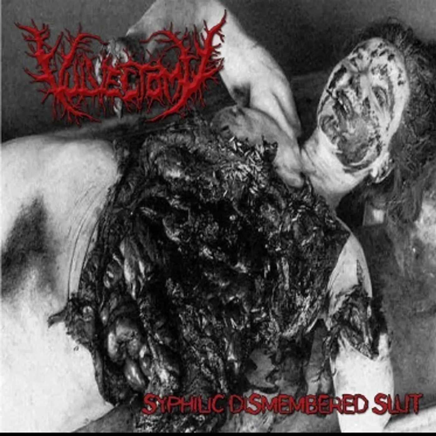 Vulvectomy SYPHILIC DISMEMBERED SLUT Vinyl Record