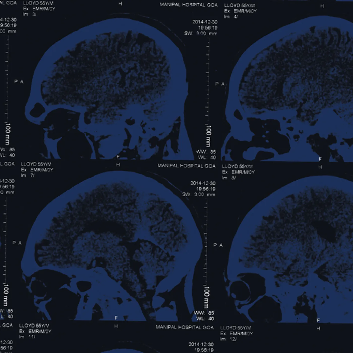 The Nightingales MIND OVER MATTER CD
