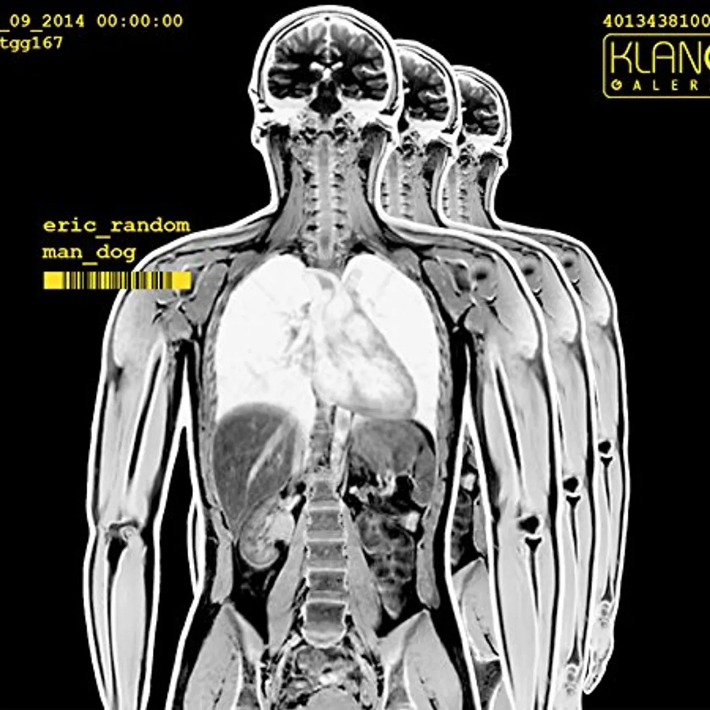 Eric Random MAN DOG CD