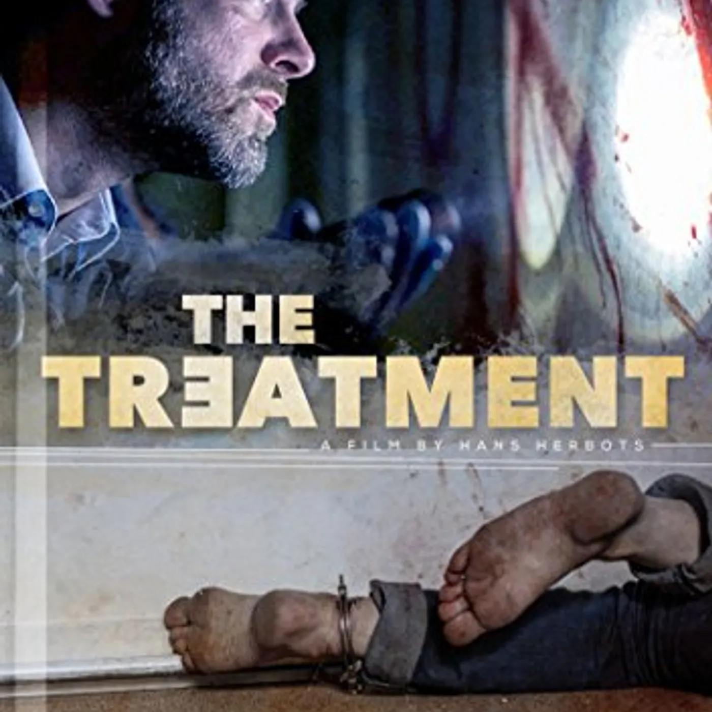 The Treatment DVD