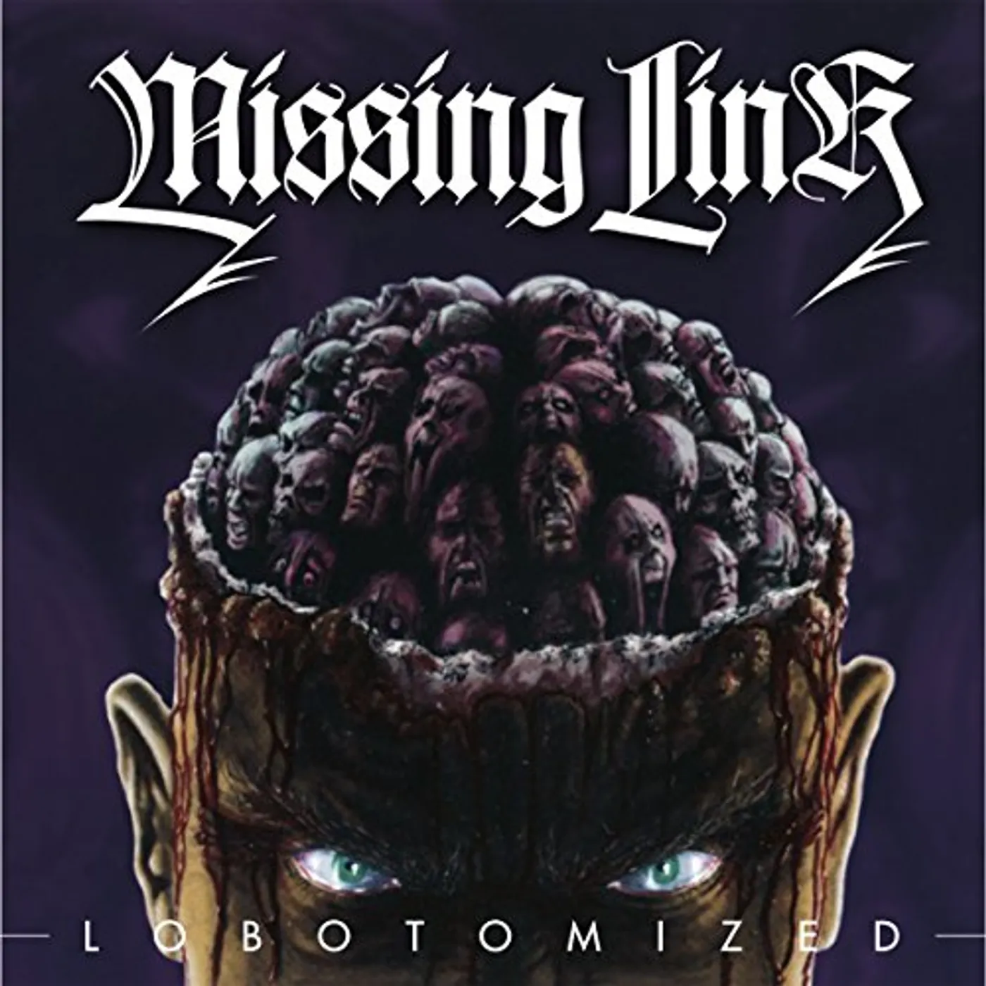 Missing Link LOBOTOMIZED CD