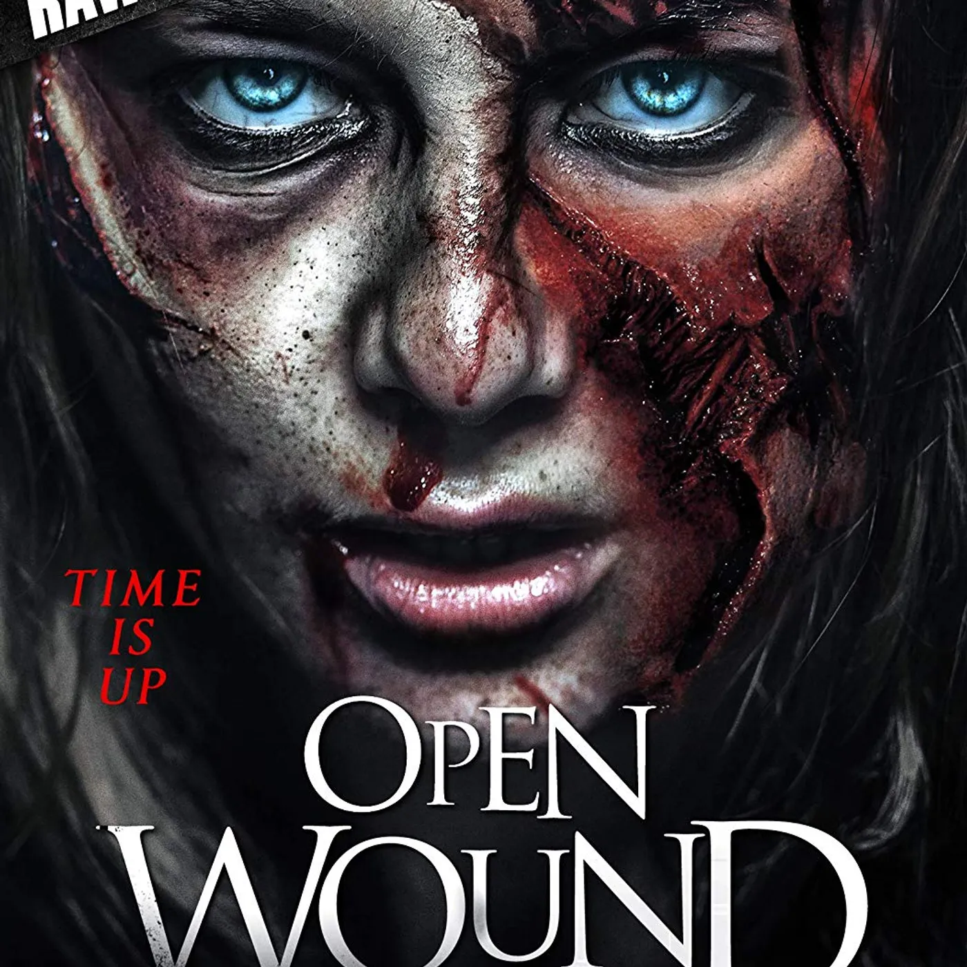 Open Wound Brand Page