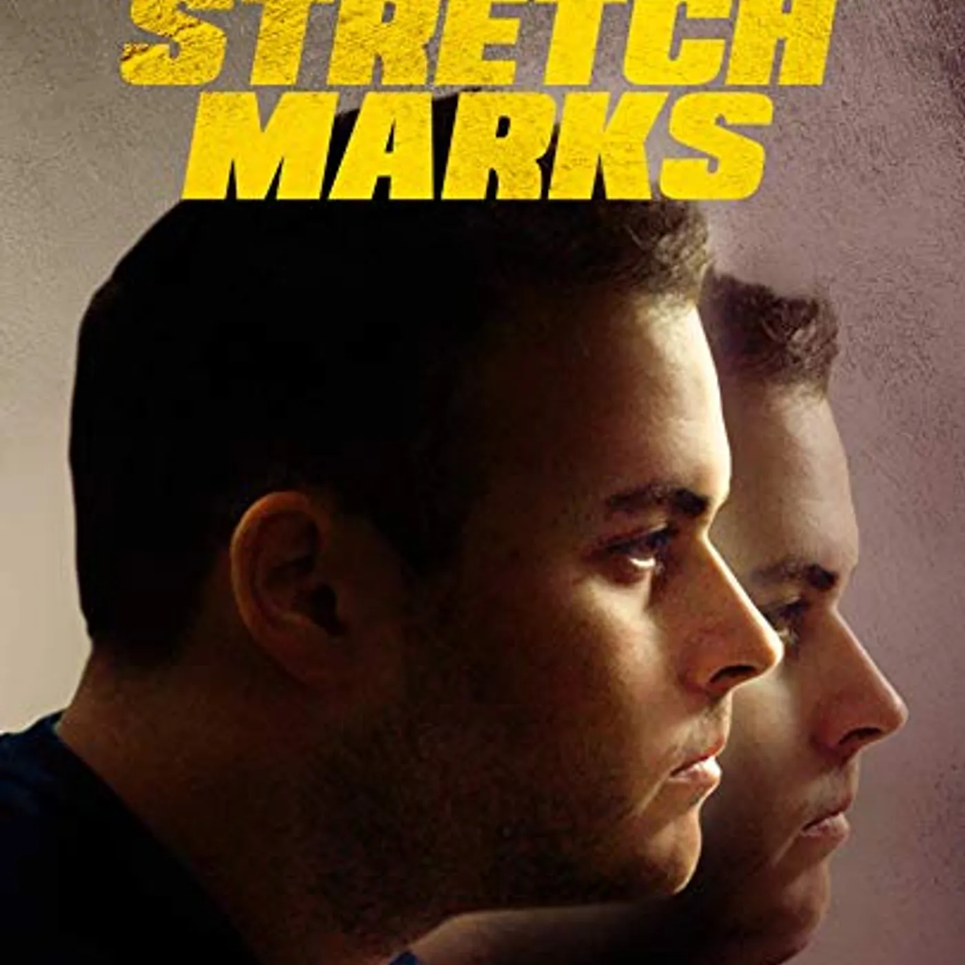 Stretch Marks DVD